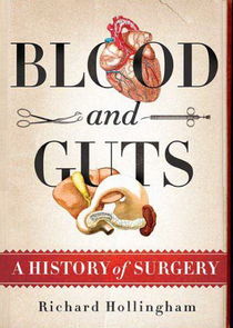 Blood and Guts: A History of Surgery Ne Zaman?'