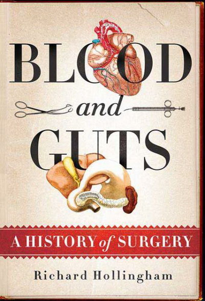 Blood and Guts: A History of Surgery ne zaman