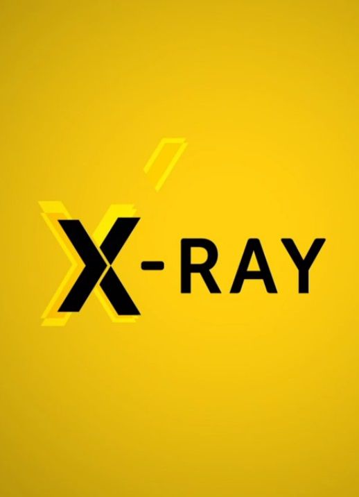 X-Ray ne zaman