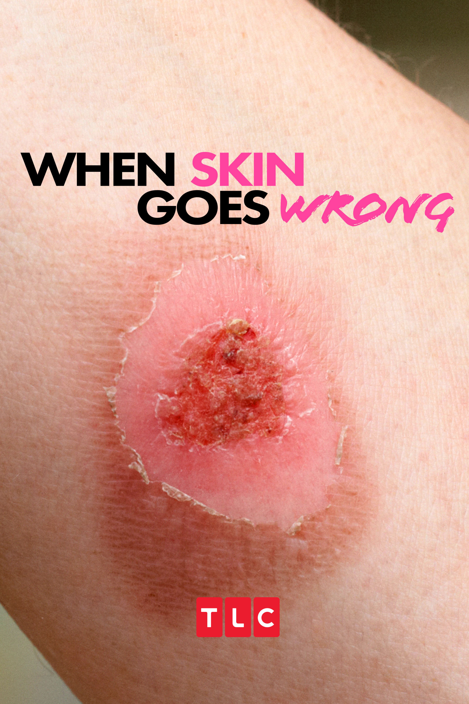 When Skin Goes Wrong ne zaman